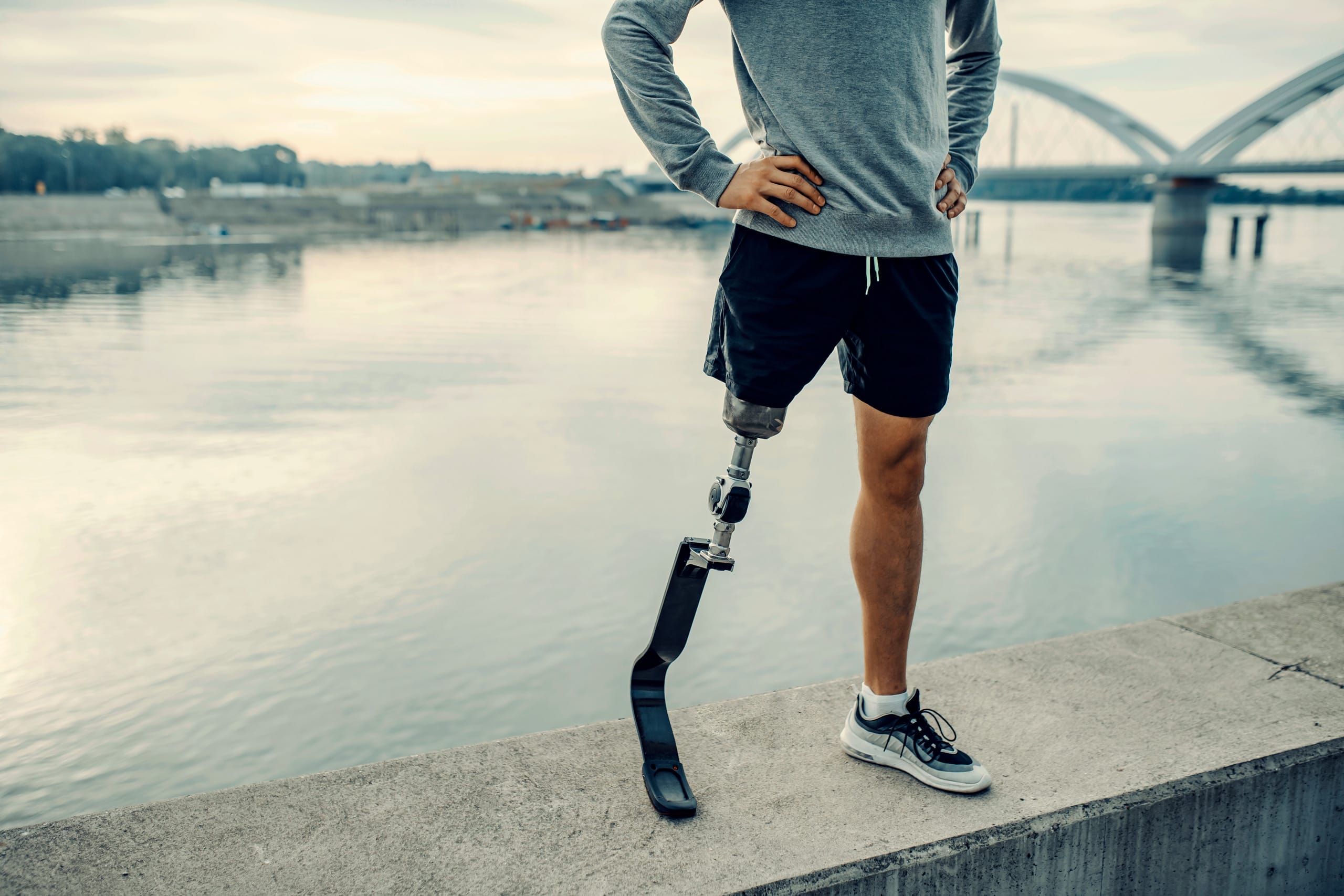 A person with a prosthetic leg stands confidently on a concrete ledge by a river, wearing a grey sweatshirt and black shorts, with a bridge and calm water in the background.
